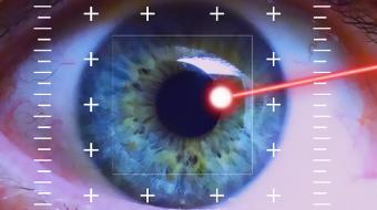 no touch laser eye surgery