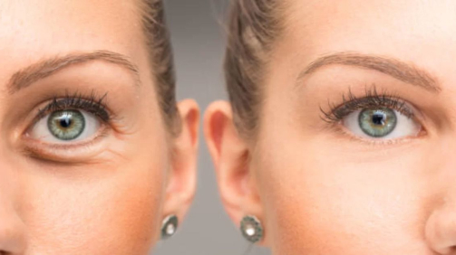 Цены на эстетику глаз