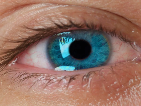 Göz İçi İltihabı Nedir?