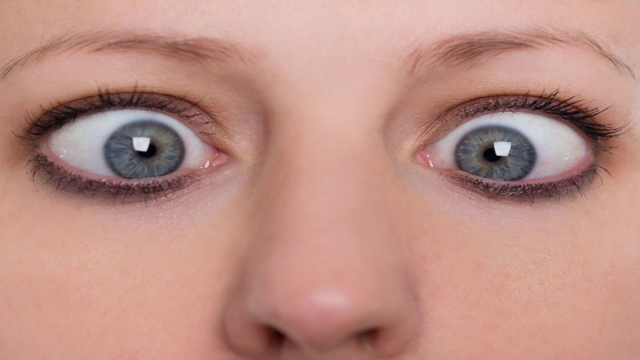 Göz Şaşılığı Nedir?