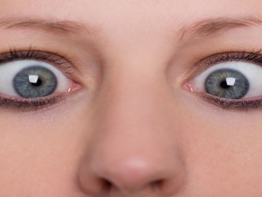 Göz Şaşılığı Nedir?