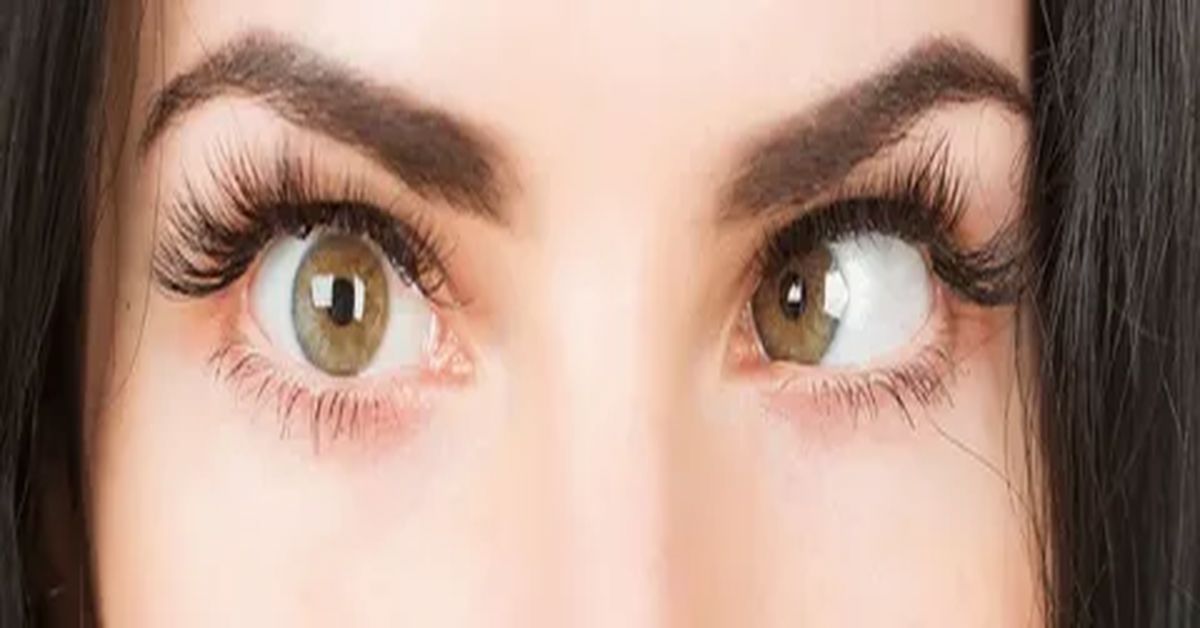 Göz Şaşılığı Tedavisi