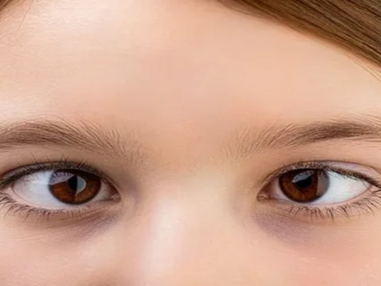 Şaşılık Ameliyatı Nasıl Yapılır